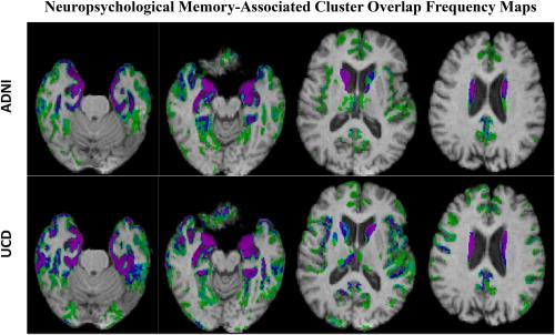 Figure: Percentage overlap of significant gray matter cluster associations at t = 3 to memory over 40 random trials in each cohort. Percentage frequency coding ranges from light green (2.5%, i.e., 1/40) through blue (60% or 24/40), to purple (100%, i.e., 40/40).